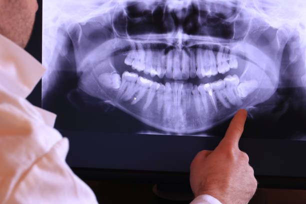 Best Emergency Dentist Near Me  in Collierville, CA