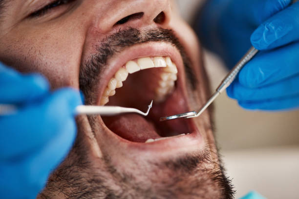 Best Broken Tooth Emergency  in Collierville, CA